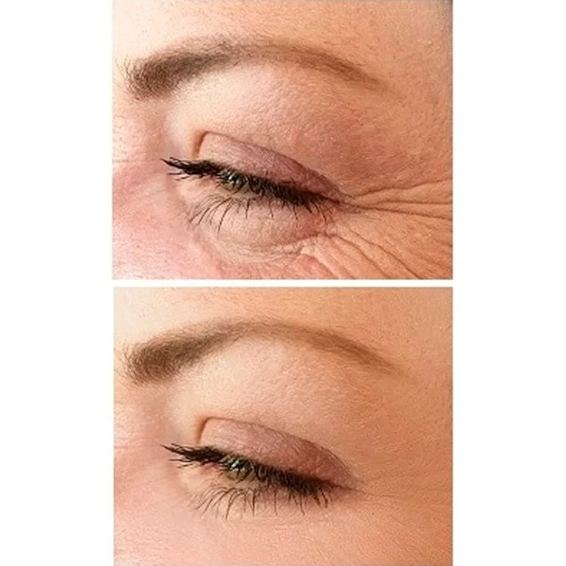 No.1 Lifting krema za oči 15 ml