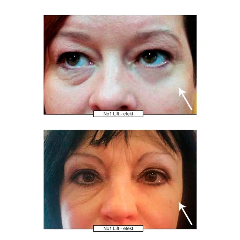 No.1 Lifting krema za oči 15 ml