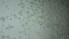 Učinkovite metode za boj proti plesni na steni