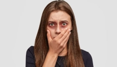 Kako zdraviti modrice s preverjenimi naravnimi metodami